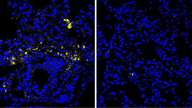 How one amino acid might help fight colon cancer and infections