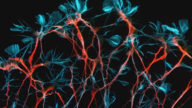 Frontiers | Structural synaptogenesis superior to functional modulation in a pruning-based recurrent network model of OCD