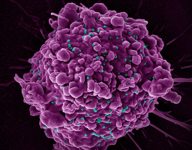 New HIV vaccine shows unprecedented success in preclinical study