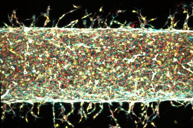 MIT engineers find a precise way to grow artificial blood vessels