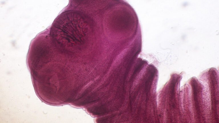 Parasites Are Causing Explosive Diarrhea to Surge. Here’s How to Avoid The Worst Ones : ScienceAlert