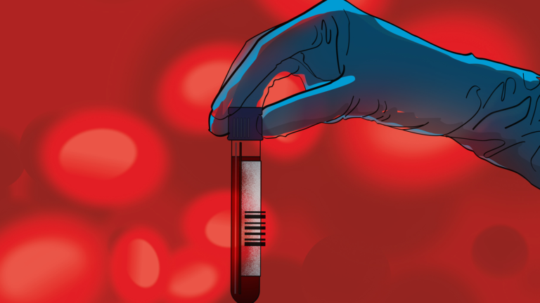 Earlier diagnosis but limited treatment options: What to know about blood tests for Alzheimer’s disease