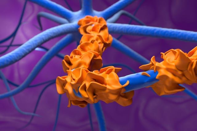 First-of-kind Guillain-Barré drug switches off part of immune system | New Scientist