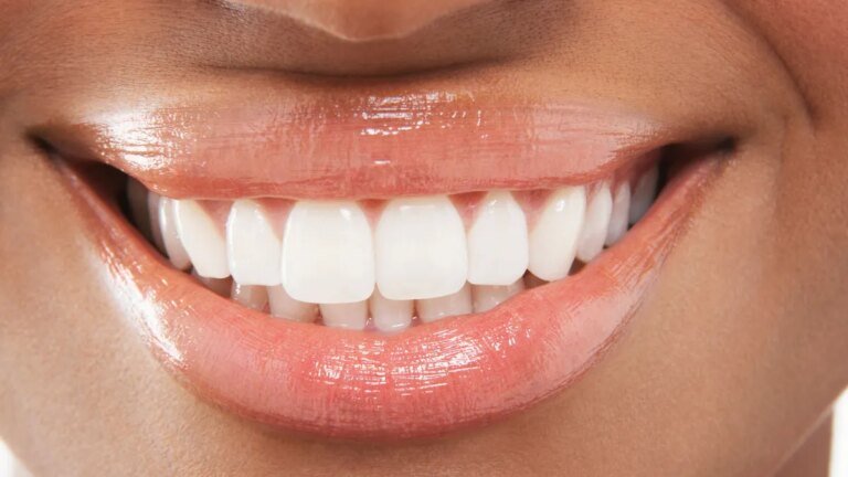 Best Whitening Toothpaste of 2026, According to Dentists