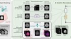 PnP-CoSMo: A Multi-Contrast MRI Reconstruction Framework based on Content/Style Modeling [R]