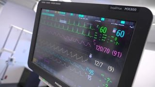Study finds less invasive heart bypass surgery as good as traditional methods, and patients recovered faster after minimally invasive procedure | Multivessel coronary artery bypass grafting via small thoracotomy versus sternotomy (MIST)